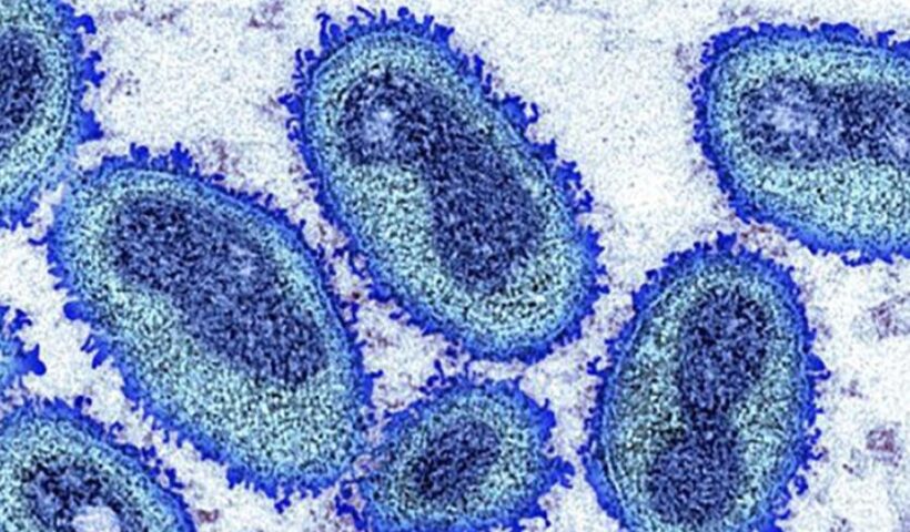 Imagem do vírus da varíola dos macacos. Sobe para 33 o número de pessoas com varíola do macaco na região